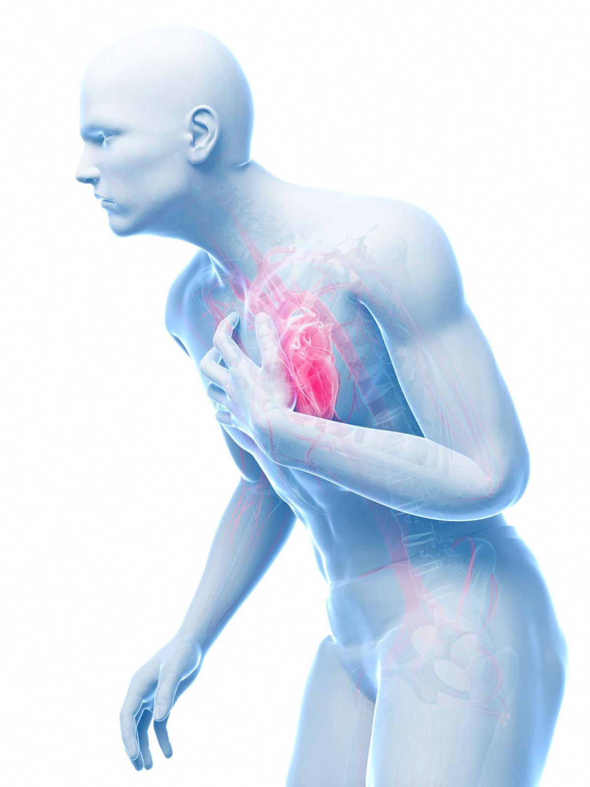 Chest Pain / Angina