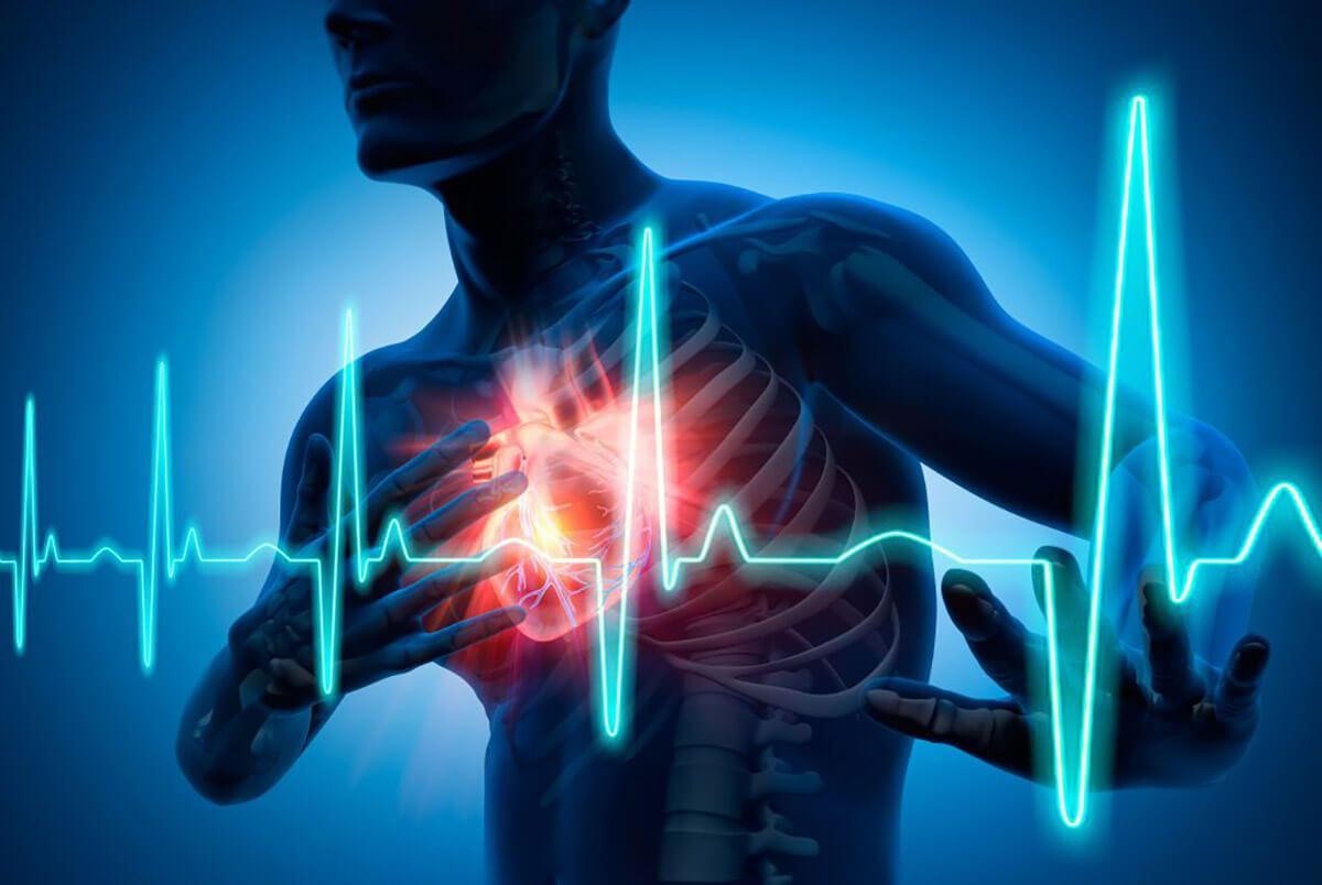 Palpitations / Syncope