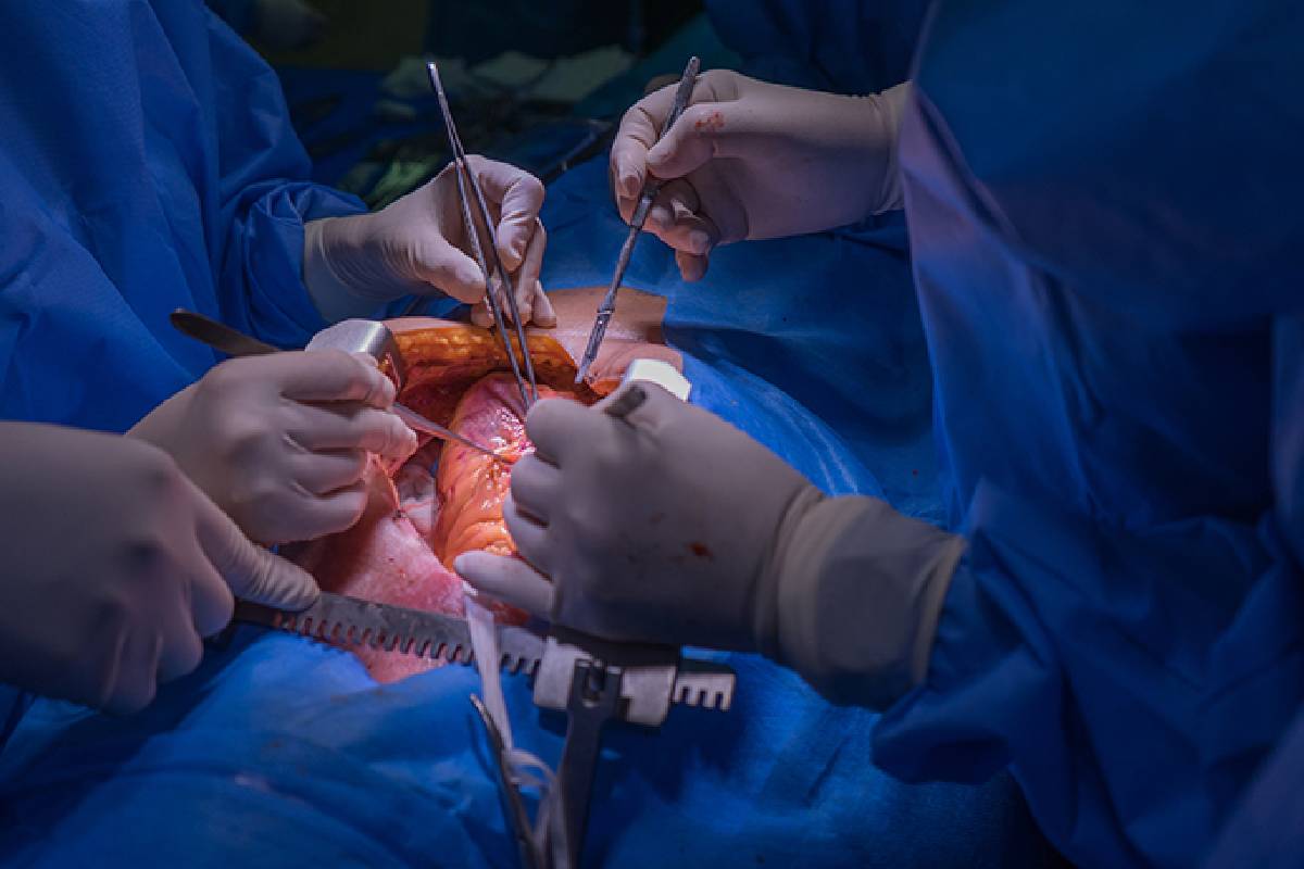 Heart Failure & Transplant